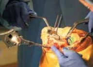 Clinical Image