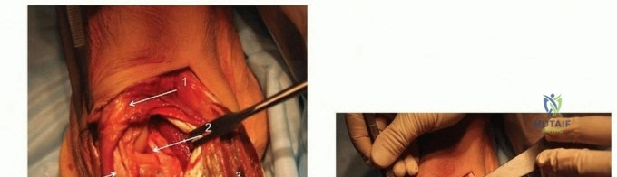 Clinical Image
