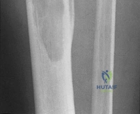 Clinical Image