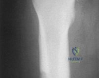 Clinical Image