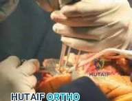 Clinical Image