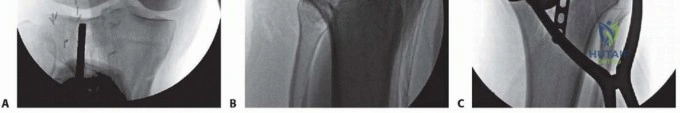 Clinical Image