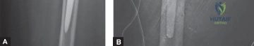 Clinical Image
