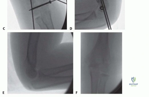 Clinical Image