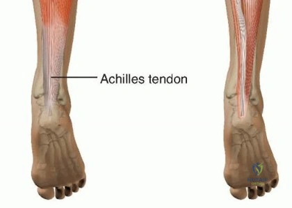 Clinical Image