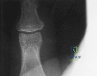 Clinical Image