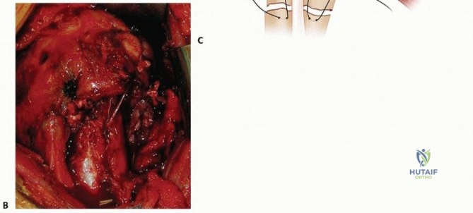 Clinical Image