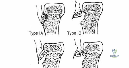 Clinical Image