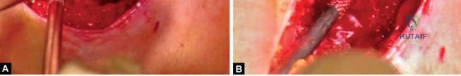 Clinical Image
