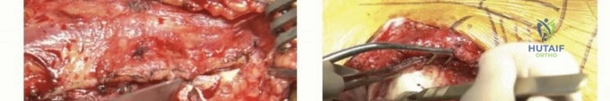 Clinical Image