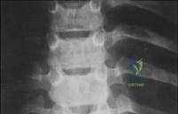 Clinical Image