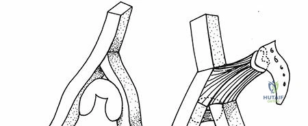 Clinical Image