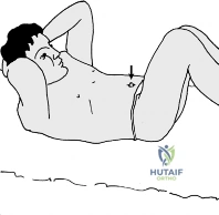 Clinical Image