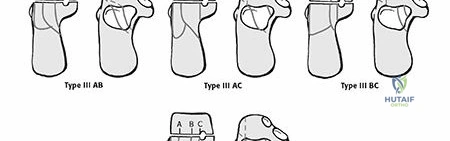 Clinical Image
