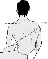 Clinical Image