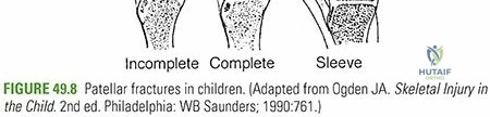 Clinical Image