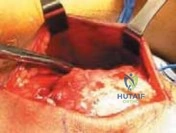 Clinical Image