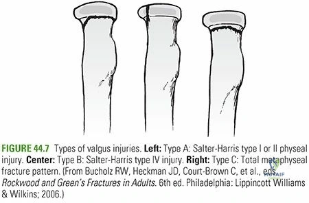 Clinical Image