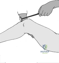 Clinical Image