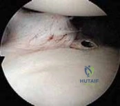 Clinical Image