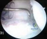 Clinical Image