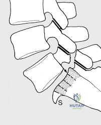 Clinical Image