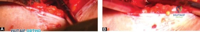 Clinical Image