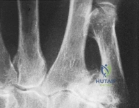 Clinical Image