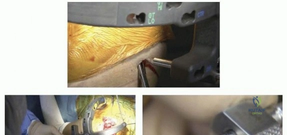 Clinical Image