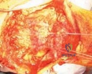 Clinical Image