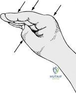 Clinical Image