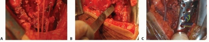 Clinical Image