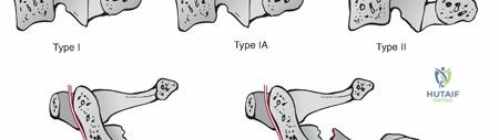 Clinical Image
