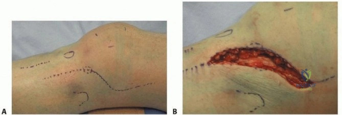Clinical Image