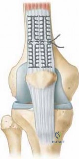 Clinical Image