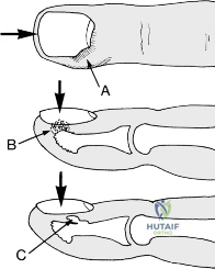 Clinical Image
