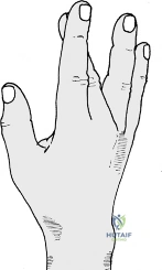 Clinical Image