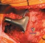 Clinical Image