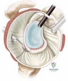 Clinical Image