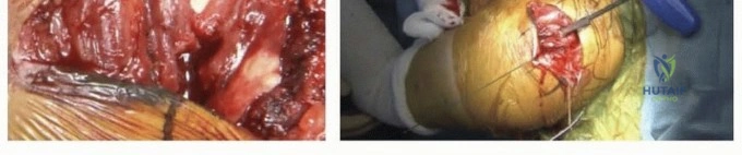 Clinical Image