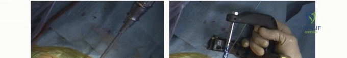 Clinical Image