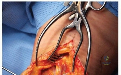 Clinical Image