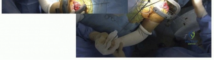 Clinical Image