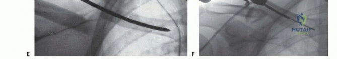 Clinical Image