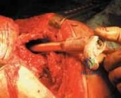 Clinical Image