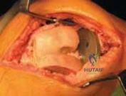 Clinical Image