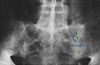Clinical Image