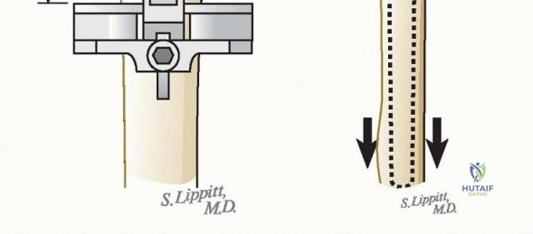 Clinical Image
