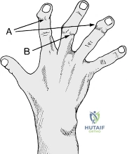 Clinical Image