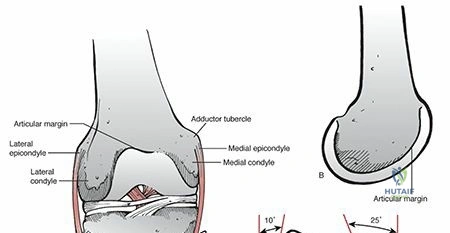 Illustration 2 for Decoding Distal Femur Fractures: Anatomy, Causes & Management